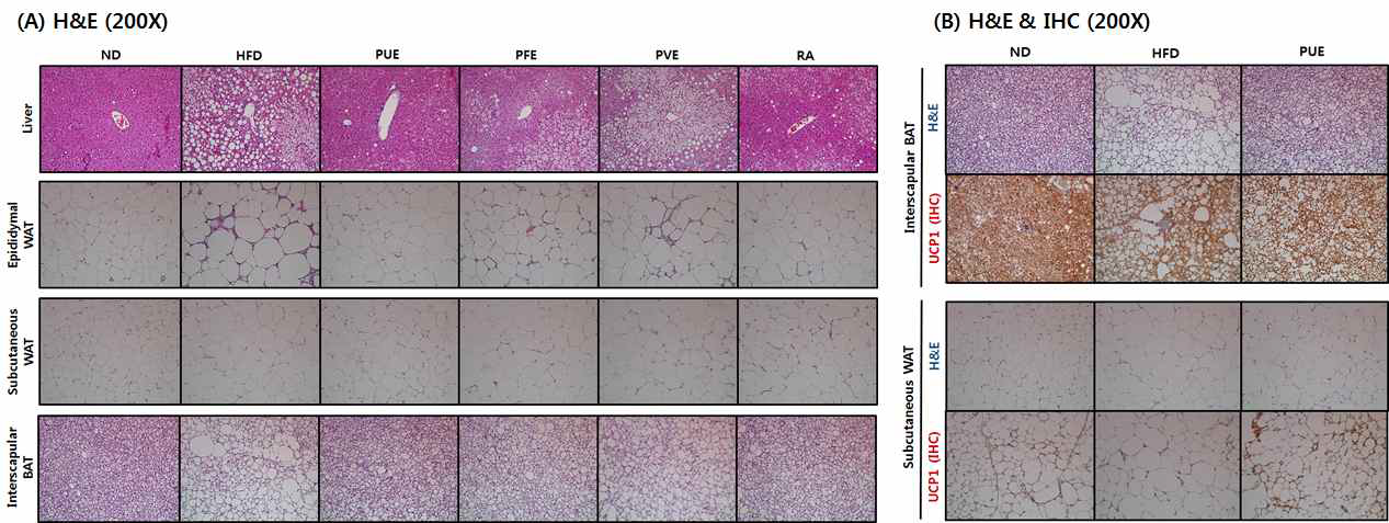 (A) Hematoxylin and eosin staining (B) Immunohistochemical staining (magnification 200×)