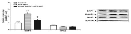 Effect of RAGE activation on mitophagy-related protein expression. Significantly different (**P<0.01) from control. Significantly different (†P<0.05) from AGE-BSA