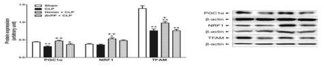 Effect of pretreatment with hemin or ZnPP on mitochondrial biogenesis-related protein expression in septic animals. The mice were administered intraperitoneally with hemin (HO-1 inducer, 10 mg/kg) at 12 h before cecal ligation and punture (CLP) or zinc protoporphyrin Ⅸ (ZnPP, HO-1 inhibitor 30 mg/kg) at 2 h before CLP. Liver tissue was collected 6 h after CLP. The results are presented as mean ± SEM of 6 to 8 mice per group. Significantly different (*P<0.05, **P<0.01) from sham. Significantly different (+P<0.05, ++P<0.01) from CLP