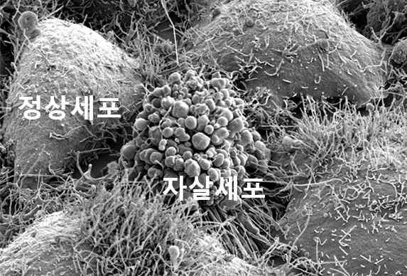 정상세포와 자살세포의 비교