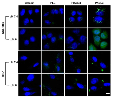 Confocal laser scanning microscopy 사진 (파란색: 핵, 초록색: 폴리펩타이드)