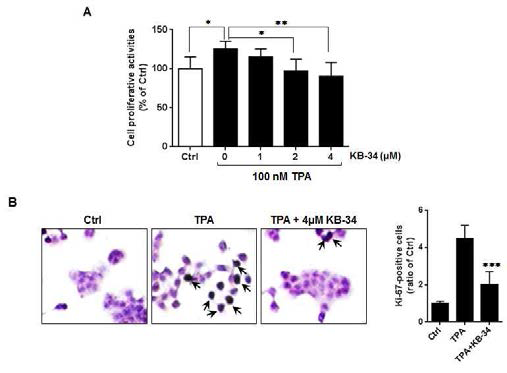 KB-34가 대장암세포의 proliferation에 미치는 영향. MTT assay (A) 및 Ki-67 IHC (B)