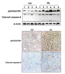 Xenograft tumor에서 p62/SQSTM1 및 cleaved caspase-8의 발현