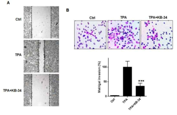 KB-34가 대장암세포의 migration (A) 및 invasion (B)에 미치는 영향