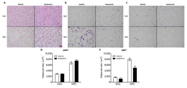 Htr2a 길항제 ketanserin 투여에 의한 brown adipose tissue (A), epididymal white adipose tissue (B), inguinal white adipose tissue (C) 의 조직 소견 및 epididymal white adipocyte (D), inguinal white adipocyte (E) 의 세포 크기