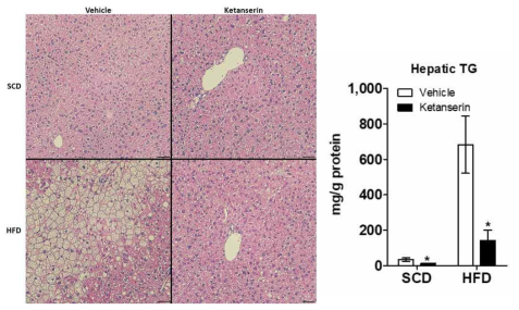 고지방식이 비만 모델에서 Htr2a 길항제 ketanserin 투여에 의한 조직 소견 및 간 조직 내 중성지방 변화