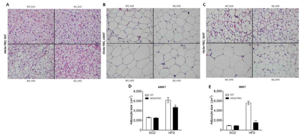 Htr2a FKO 마우스에서 brown adipose tissue (A), epididymal white adipose tissue (B), inguinal white adipose tissue (C) 의 조직 소견 및 epididymal white adipocyte (D), inguinal white adipocyte (E) 의 세포 크기