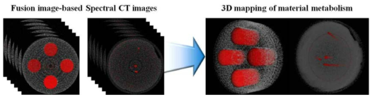 (좌)융합진단영상, (우)3차원 볼륨 렌더링을 통한 특정 물질의 대사 지도