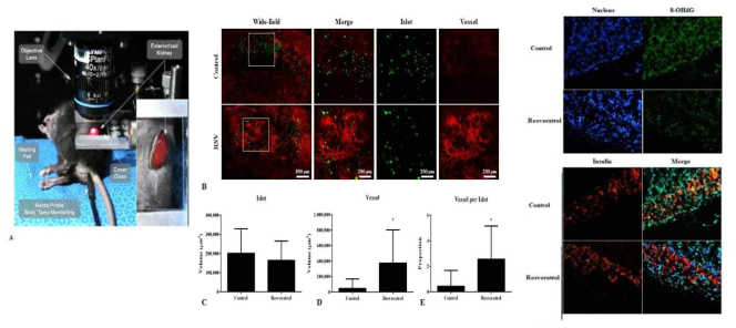 췌도이식후 3일째 대조군과 RSV 투여군에서 이식췌도 절편의 angiogenesis 비교. Mosaic intravital images (A, B) (Green: MIP-GFP, Red: CD31). 혈관용적, 췌도용적, 췌도용적당 혈관용적에 대한 Scatter plot graphs (C-E). 대조군에 비해 RSV 투여군에서 8-OHdG 발현(green) 이 14일째 의미있게 감소함 (X400)