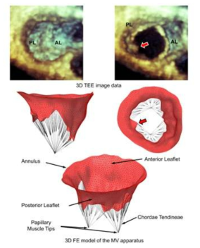 3D 심초음파 임상데이터 기반 가상 환자승모판막 모델링
