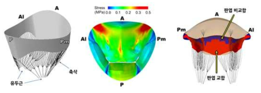 파라메트릭 승모판막 모델을 이용한 승모판막 역류증의 병리학적 메커니즘 분석