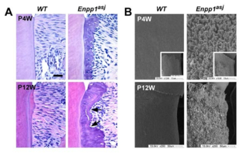 The cervical ectopic cementum of Enpp1asj mice is destroyed in late cementogenesis