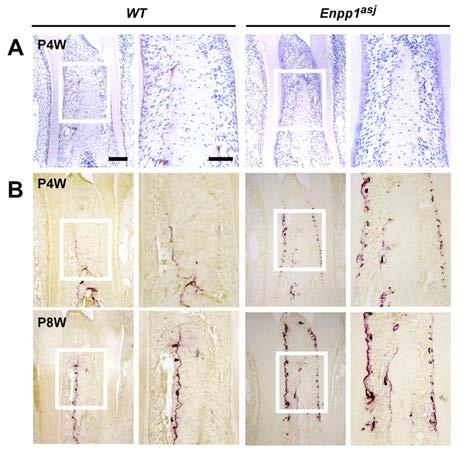 Osteoclastic activity is increased in the periodontium of Enpp1asj mutant mice