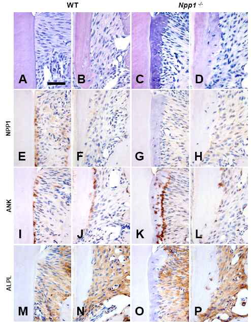Pyrophosphate regulators in cementum in Enpp1asj mutant mice