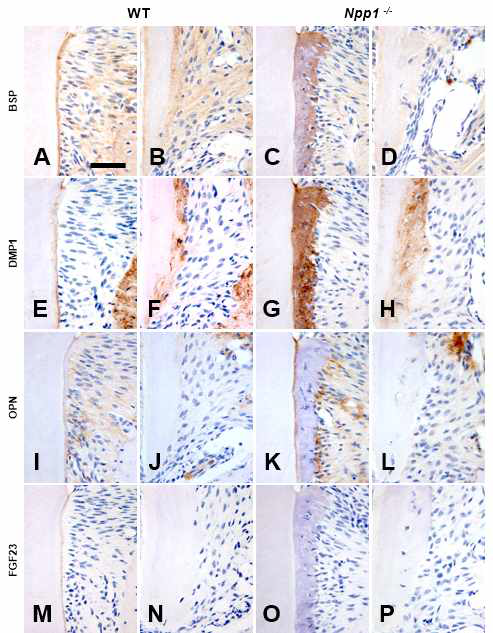 Extracellular matrix proteins in cementum in Enpp1asj mutant mice