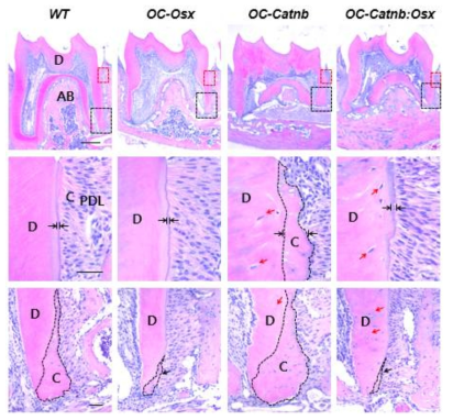 In vivo regulation of cementum formation by stabilized β-catenin and Osx