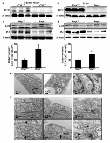 Suppression of PrPactivated autophagy flux in adipose tissue and adipocyte