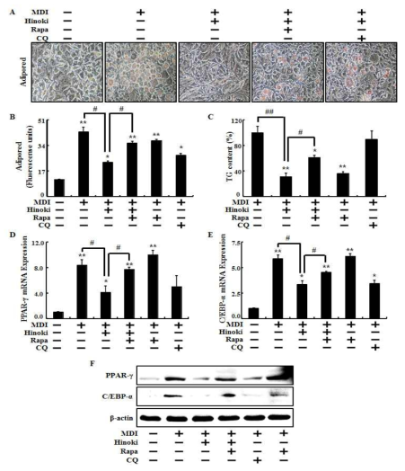 induction of autophagy restored inhibited adipocyte differentiation by hinokitiol in mesenchymal stem cells