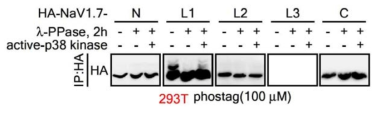 HEK293T에서 발현시킨 N-terminal, Loop1, Loop2, Loop3와 C-terminal을 정제 후 γ -phosphatase로 탈인산화 시켰다가 p38 MAP kinase로 phosphorylation 시킨 후 phostag gel에서 확인