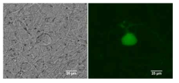 Biolistics transfection을 기법으로 GFP와 hNav1.7 나트륨 통로를 동시에 발현시킨 DRG 신경세포의 bright field image (a)와 fluorescence image (b)