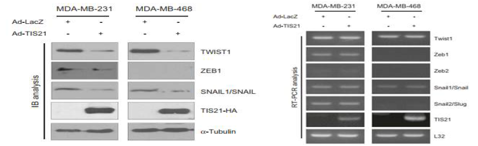 BTG2/TIS21과발현 후 Twist1 단백질 발현 감소