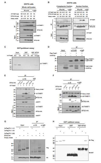 Twist1 C-terminal domain 과 BTG2/TIS21 단백질 Box B domain과의 결합 확인