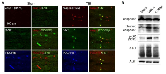 노화촉진 뇌손상 이후 혈관주위세포는 세포사멸인자(casp 3 (D175)) 및 peroxynitrite 마커 (3-NT)와의 상관성이 높아짐 (A-B). 또한, 활성산소와 상호작용하는 염증 물질인 p-65 (NF-κB 구성인자) 발현이 증가함