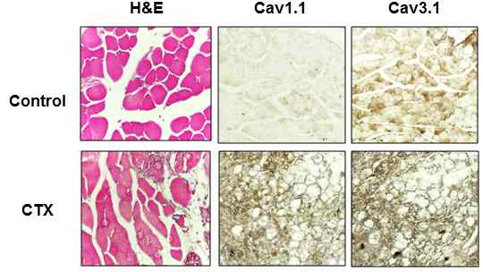 정상근육과 CTX를 주입에 의해 손상·재생중인 근육조직에서 Cav1.1과 Cav3.1 단백질의 발현을 면역염색법을 통해 관찰함
