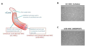 제대의 Wharton’s jelly에 존재하는 UC-MSC(A), fibroblast 형태인 Cefobio사의 UC-MSC와 MEDIPOST사의 UCB-MSC