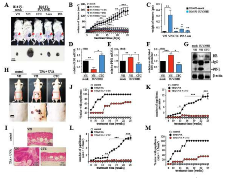 SUV39H1-mediated methylation of the RB1 promoter promotes UVA/TPA-induced skin tumorigenesis in vivo