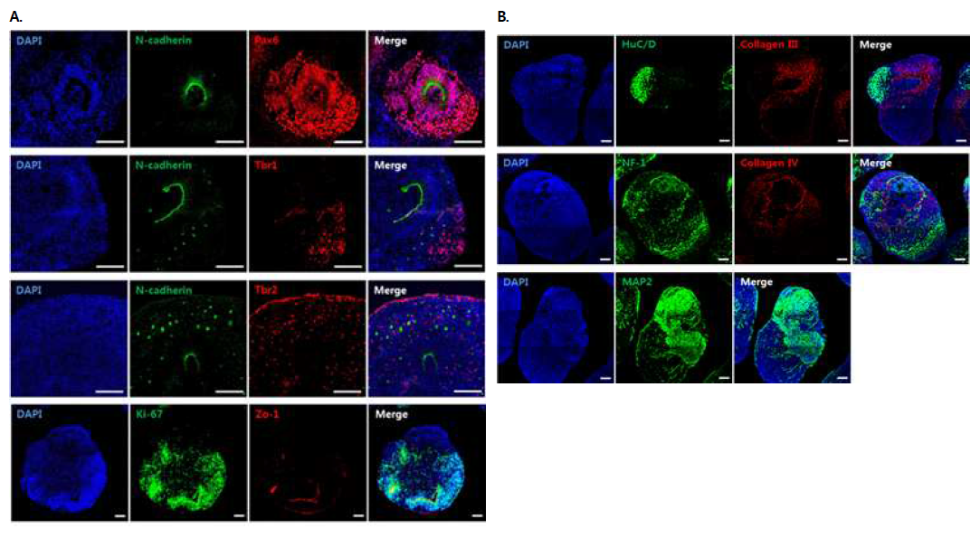 Progenitor cells marker, brain structural marker, differentiated neuronal marker들이 미니 브레인에서 관찰됨을 확인함. Scale bars : 100 μm