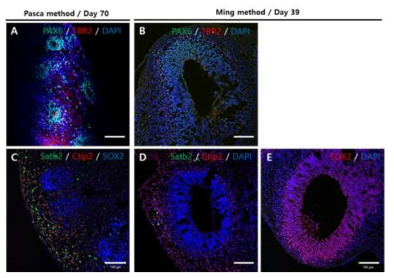 미니 브레인의 절편에서 progenitor cell marker인 Pax6(A,B), SOX2(C,E), Projection neuron marker 인 Satb2, Ctip2 (C,D), TBR2(A,B)를 면역화학염색법으로 확인한 결과. Scale bars : 100 μm