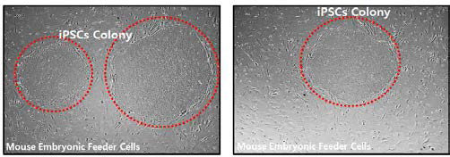 iPSCs colony가 형성된 모습