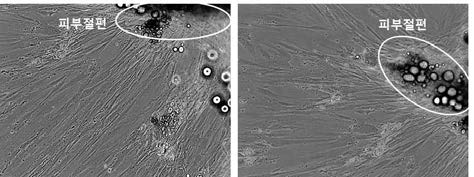 연구 대상자의 피부 절편으로부터 배양한 fibroblast