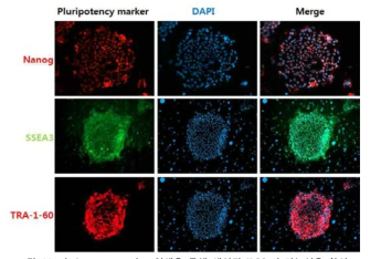 pluripotency marker 염색을 통해 생성된 iPSCs의 만능성을 확인