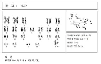 Karyotype 분석결과