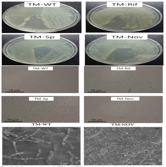 Cell morphology of different TM strains on plate and under microscopy