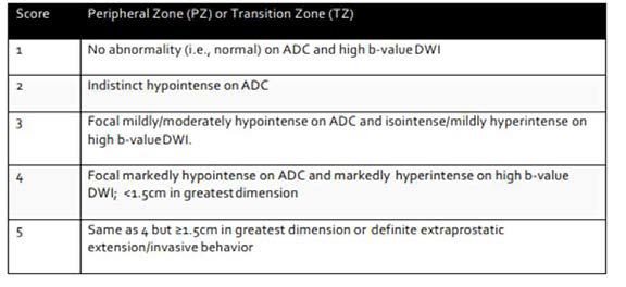 확산강조영상에서의 PIRADS version 2 분석 영상소견