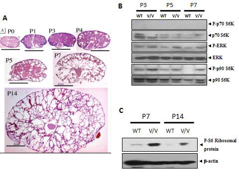 A: Pkd1V/V 쥐의 신장의 시기별 조직염색사진, B,C: Pkd1 WT과 Pkd1V/V 쥐의 신장을 시기별 Western blot