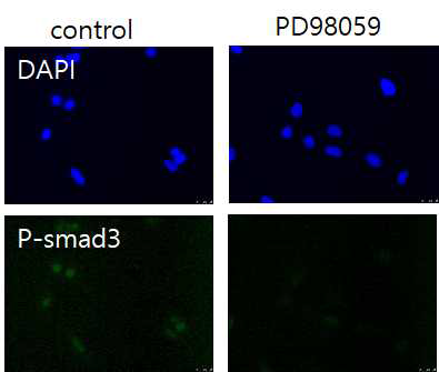 PD98059 처리 후 인산화된 smad3의 핵내 위치를 형광현미경으로 확인