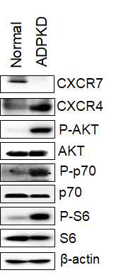 정상인과 다낭신 환자의 신장 조직에서 CXCR4/7 과 AKT/p70/S6 신호 전달체계의 단백질양과 인산화 조사