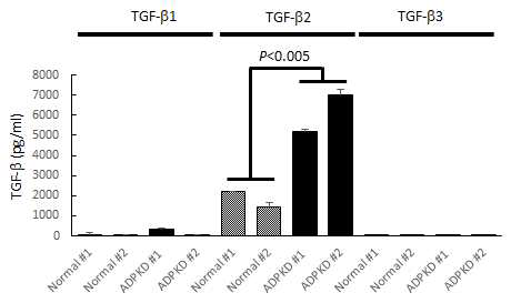 정상 세포와 낭종 세포의 배양액에서 TGF 단백질 종류를 ELISA로 분석