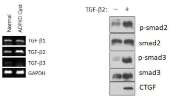 정상 세포와 다낭신 세포에서 RT-PCR로 TGF-β 1/2/3의 발현양 비교. TGF-β2만 처리한 경우 smad2/3가 황성화 되는지 그리고 CTGF의 발현양의 변화를 조사