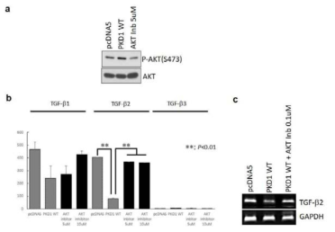 (A) PC1이 과발현하는 IMCD 세포에 AKT inhibitor를 처리하여 AKT 활성화 여부 조사 (B) IMCD 세포의 배양액에서 AKT inhibitor를 처리한 경우 TGF-β2의 분비를 ELISA로 조사 (C) AKT inhibitor를 처리한 경우 TGF-β2의 mRNA 발현양을 RT-PCR로 조사