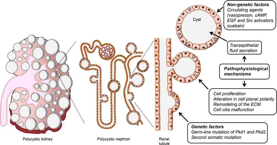 다낭신의 진행 과정 (Am J Physiol Renal Physiol, 2013)