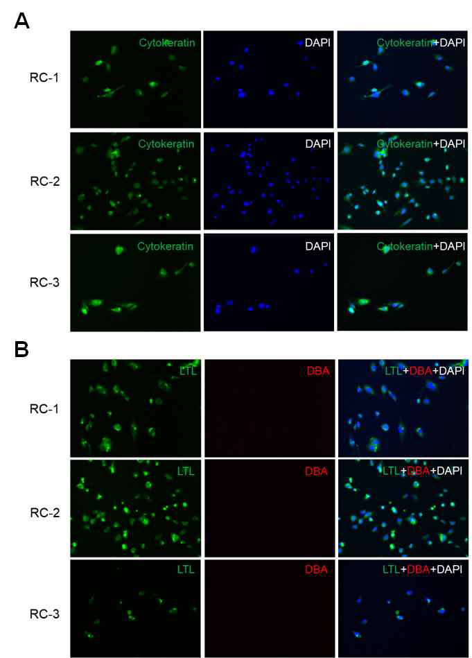Renal cyst (RC) 세포주들의 특성 조사. (A) 표피세포 마커인 cytokeratin으로 염색 (B) Proximal tubule 마커인 LTL과 collecting duct 마커인 DBA로 형광염색