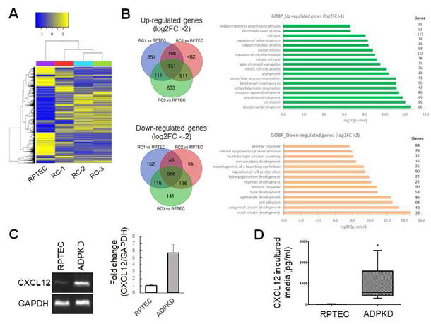 (A) 다낭신 환자의 Renal Cyst(RC) 세포의 RNA Seq (B) Up- and down-regulation 유전자들의 Gene Ontology(GO) 분석 (C) CXCL12의 RT-PCR을 통한 mRNA 발현양 조사 (D) 세포 배양액에서 CXCL12의 양을 ELISA 분석