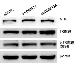 DNMT1, DNMT3A 발현의 변화에 따른 DNA damage 관련 단백질의 발현 조사