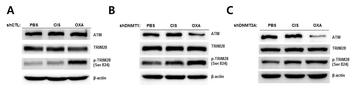 DNMT 단백질 발현이 감소된 EBV-양성 위암세포주에서의 DNA damage관련 단백질발현 조사. (A) EBV-양성 위암 세포주에서는 저농도의 Oxaliplatin 처리 시 TRIM28의 인산화가 증가함. (B) DNMT1의 발현이 감소된 EBV-양성 위암 세포주의 항암제 처리결과, Oxaliplatin 처리군에서만 TRIM28의 인산화를 확인함. (C) DNMT3A의 발현이 감소된 EBV-양성 위암 세포주에서는 Cisplatin과 Oxaliplatin 처리군 모두 TRIM28의 인산화가 증가함