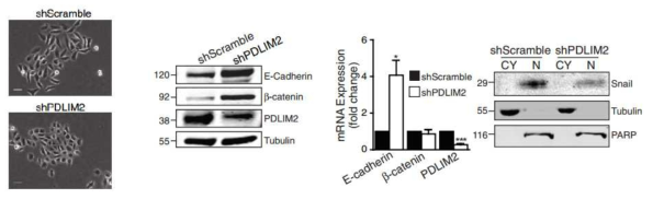 암세포에서 PDLIM2의 발현 조절에 따른 EMT 마커의 변화 양상 (1)